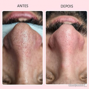 Massagem, Depilação, Limpeza de Pele